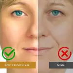 OUHOE Botox Bee Venom Skin Treatment Cream