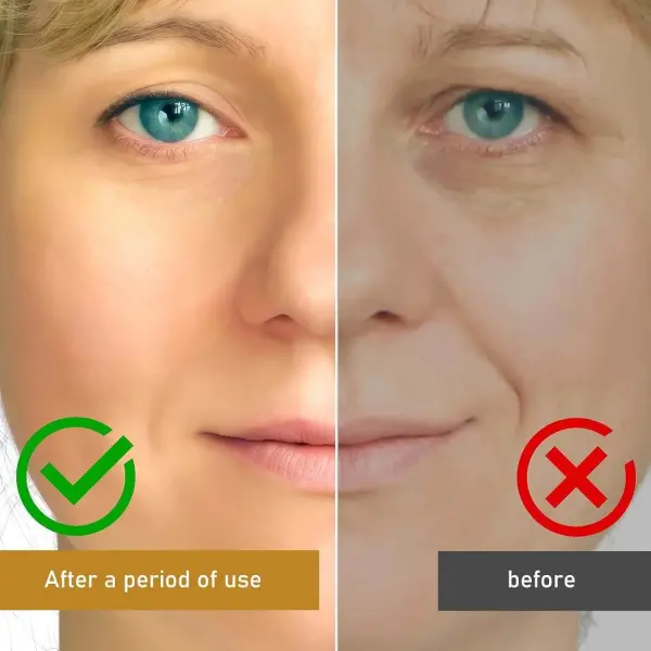 OUHOE Botox Bee Venom Skin Treatment Cream