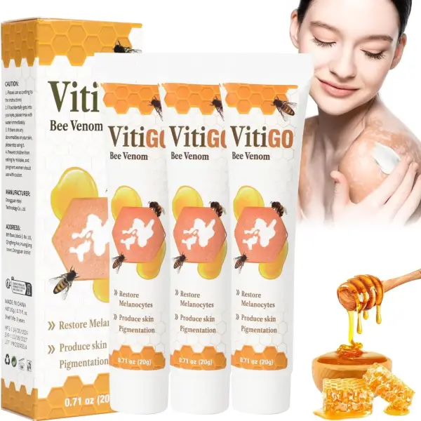 Vitigo Been Venom Treatment Cream For Skin and Rashes