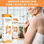 Vitigo Been Venom Treatment Cream For Skin and Rashes
