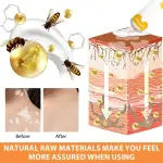 Vitigo Been Venom Treatment Cream For Skin and Rashes