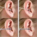 Stainless Steel Earwax Removal Kit